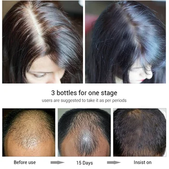 7 Zile De Creștere A Părului Ulei Esențial De Ghimbir Tratament Scalp Ser Anti Caderea Parului Produse De Reparare Creț Deteriorat A Restabili Parul Gros